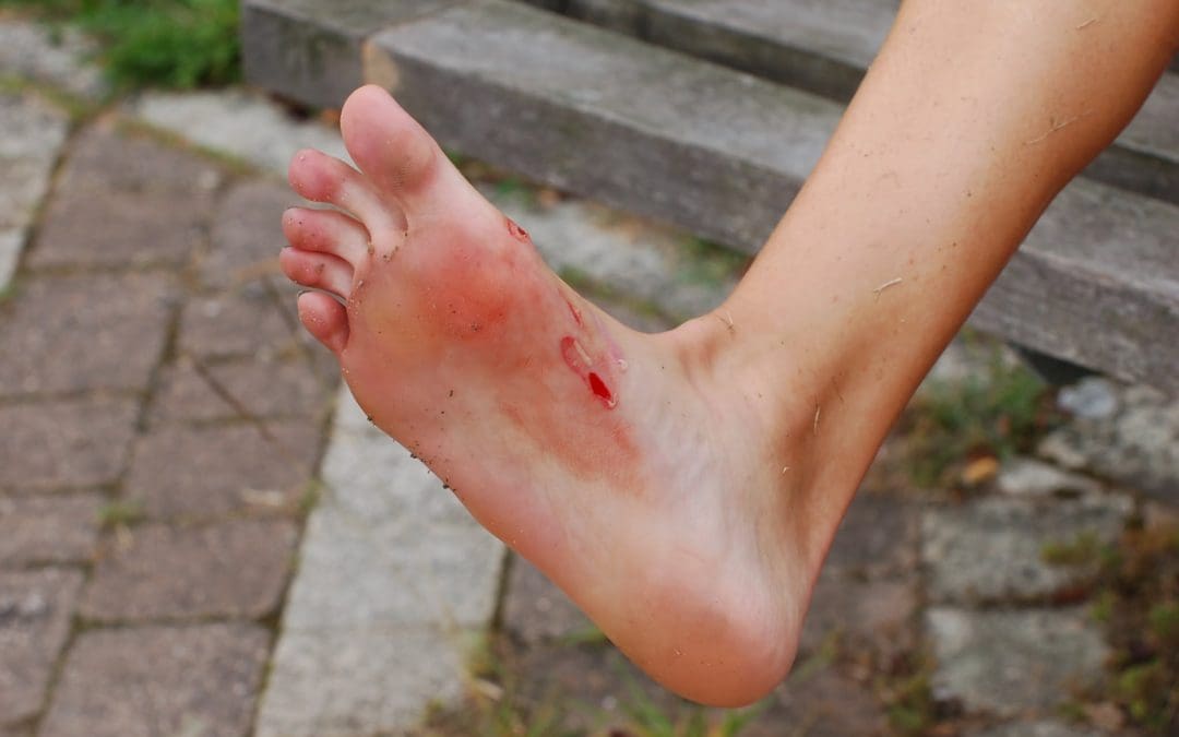 Hugo Ogando, fisioterapeuta: “A nivel tendinoso, que o teu primeiro tríatlon sexa un medio é unha barbaridade”